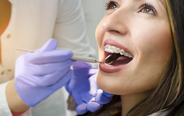 Tips To Choose The Best Melbourne Orthodontist
